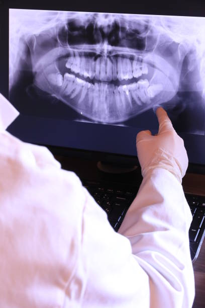 Best Emergency Dental Extractions in Ovilla, TX